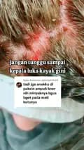 Obat Kutu Rambut-obatkuturambut_