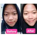 skincare Resmi BPOM ✅-paling_murah3