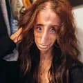 Lizzie Velasquez-littlelizziev