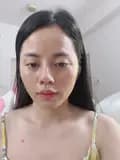 Thảo Beauty ( Chuyên Trị Mụn)-thao_phan8888